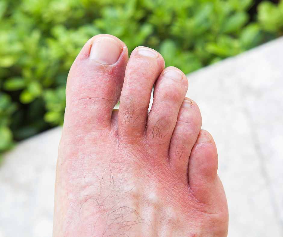 Common Toe Problems That Can Make Feet Look Abnormal