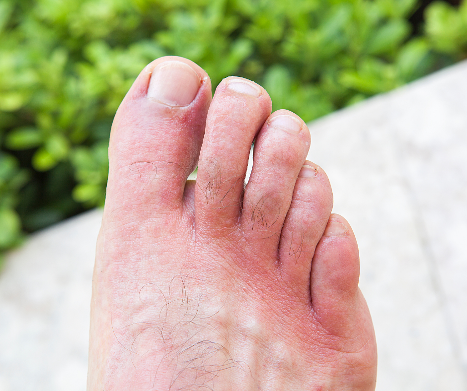 Why Are My Feet Itchy Our Top Tips For Itchy Toes And Feet My FootDr