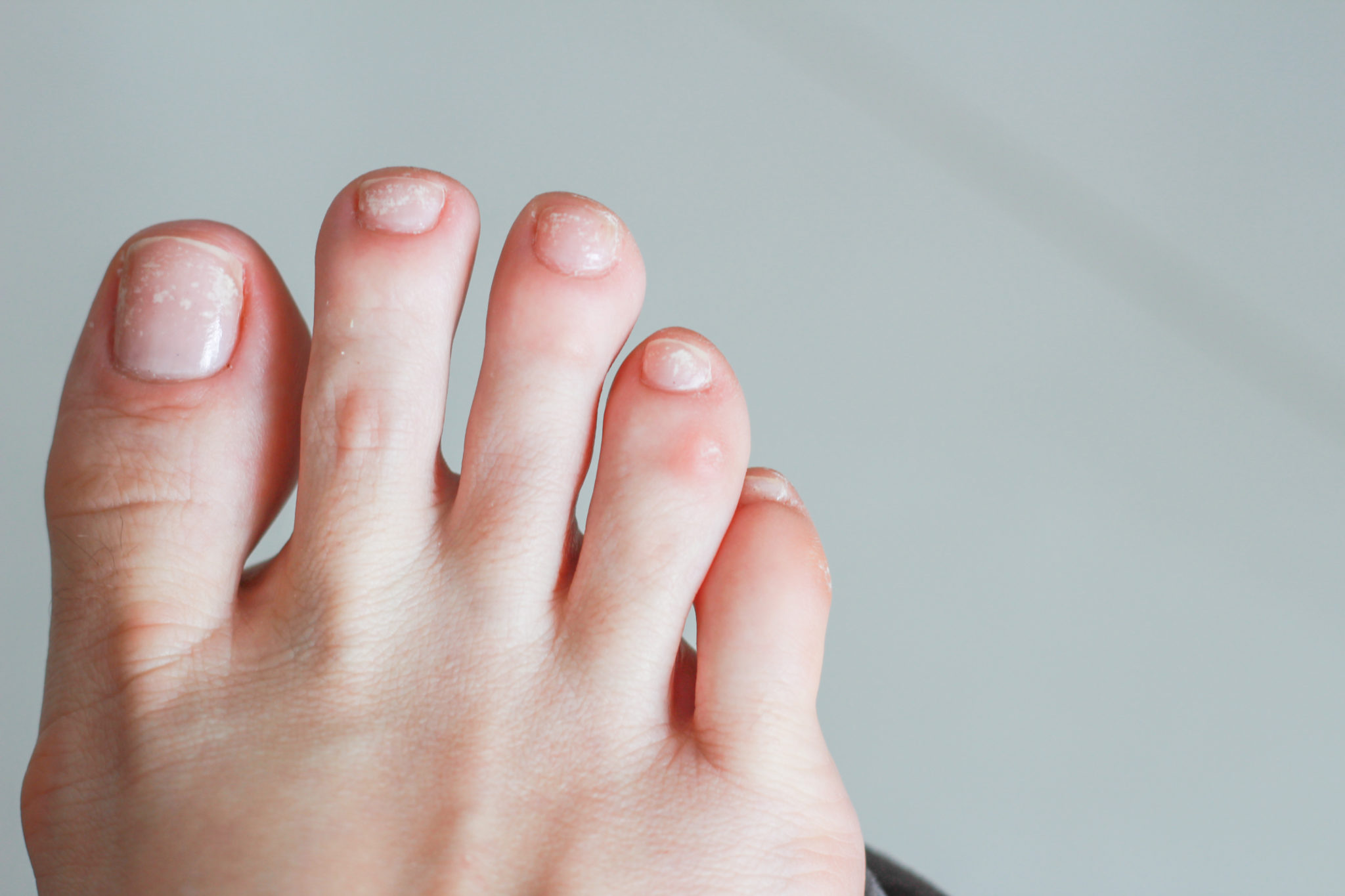 toe nail polish color for pale skin