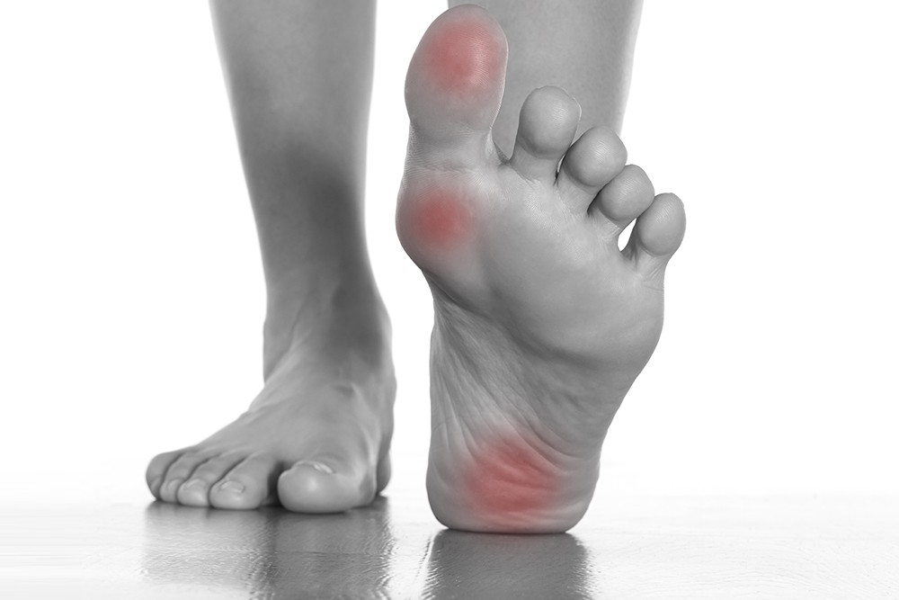 Callus removal from feet: balls of feet 