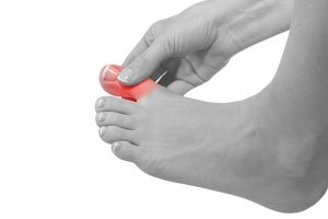 Simple Guide To Ingrown Toenail Infection And Symptoms