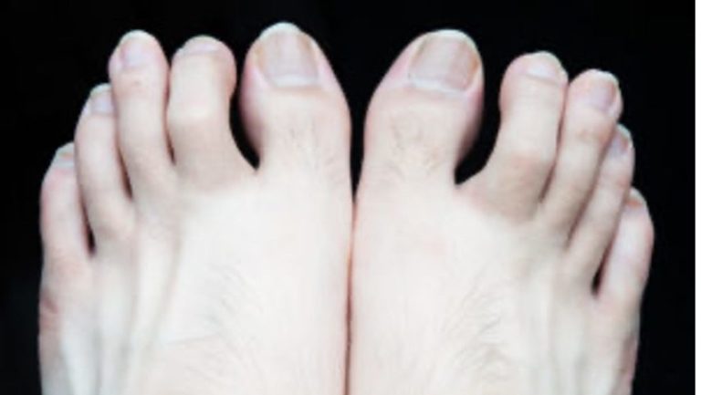 Gender Differences In Foot Problems – My Footdr